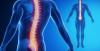Photo for Spine Biologics Market Size Worth $2.5 Billion By 2026