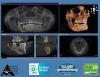 Photo for CBCT 3D DENTAL IMAGING, SMART PROTOCOL DENTIST, MERCURY FREE, BIOLOGICAL CERTIFIED DENTIST RI