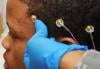 Photo for Global Neurology Devices Market Size, Share, Growth, Trends, Industry Analysis Report, 2022