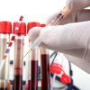 Photo for Global Blood Screening Market 2019-2024 Latest Technology Usages