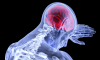 Photo for Cerebral Spinal Fluid Management Market Size, Share, Growth, Trends and Forecast Report, 2012 to 2022