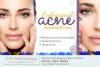 Photo for Acne in Plano TX - Acne Skin Care