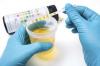 Photo for Global Urinalysis Market Research Report - Industry Analysis, Size, Share, Growth, Trends and Forecast Till 2026