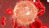 Photo for Hematologic Malignancies Market Size Worth $85.8 Billion By 2025