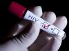 Photo for HIV Diagnostics Market Is Expected To Reach USD 4.48 Billion In 2022