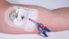Photo for Catheter Stabilization Devices Market Size Worth $1.83 Billion By 2025