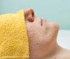 Photo for Acne Skin Care Treatment Jupiter FL