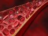 Photo for Fibrocyte Market Size, Share, Trends & Analysis By Key Players, Types and Application 2020-2024