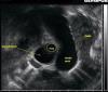Photo for Global Lung cancer diagnostics Market Size, Share, Growth, Trends and Forecast Report, 2024