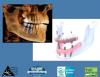 Photo for 3D dental images, Implant Dentist RI, Top Dentist RI, Mercury Safe Removal