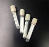 Photo for Anticoagulation Tube Market Is Set To Grow Exponentially In The Forthcoming Years 2020-2024