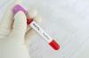 Photo for Global Bird Flu Treatment Market 2020 | Manufacturers, Regions, Type and Application, Forecast to 2025