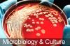 Photo for Microbiology Culture Market 2020: Industry Growth, Trends and Research Report, To 2025