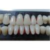 Photo for Artificial Acrylic Teeth Market 2020: Industry Growth, Trends and Research Report, To 2025