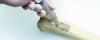 Photo for Bone Grafts & Substitutes Market Size Worth $3.54 Billion By 2026