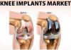 Photo for Knee Implant Market Size To Reach $12.3 Billion By 2024