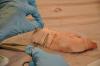 Photo for Global Surgical Sutures Market Size, Share, Growth and Trend Analysis Report, 2019 to 2025