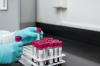 Photo for Global Vitamin D Testing Market Size, Share, Growth, Trend and Industry Analysis Report, 2018 to 2025