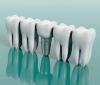 Photo for The benefits of dental implant restorations near Lemoore, CA
