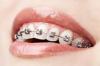 Photo for Buy Dental Crowns for you Clinic