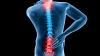 Photo for Osteoarthritis Pain Drugs Market 2013-2028 - Industry Trends, Market Size, Segments, Growth Prospects: Radiant Insights, Inc