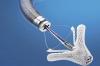 Photo for Global Cardiovascular Device Market Research Report - Industry Analysis, Size, Share, Growth, Trends and Forecast Till 2026