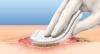 Photo for Global Wound Debridement Market 2020 | Manufacturers, Regions, Type and Application, Forecast to 2025