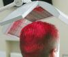 Photo for Global Laser Hair Loss Treatment Market 2020 | Manufacturers, Regions, Type and Application, Forecast to 2025