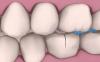Photo for RCT Dental Clinic (Endodontics)