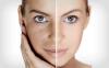 Photo for Global Skin Rejuvenation Market Research Report - Industry Analysis, Size, Share, Growth, Trends and Forecast Till 2026