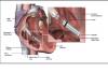 Photo for Global Leadless Pacing Systems Market Research Report - Industry Analysis, Size, Share, Growth, Trends and Forecast Till 2026