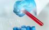 Photo for Global Blood Collection Tubes Market Research Report - Industry Analysis, Size, Share, Growth, Trends and Forecast Till 2026