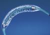 Photo for Global Nitinol Medical Devices Market Research Report - Industry Analysis, Size, Share, Growth, Trends and Forecast Till 2026