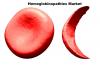 Photo for Global Hemoglobinopathies Market Trends Estimates High Demand By 2026