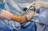 Photo for Global Arthroscopy Devices Market Research Report - Industry Analysis, Size, Share, Growth, Trends and Forecast Till 2026