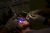 Photo for Dental Lasers Market Size, Share, Growth, Trends and Industry Statistics Report, 2019 to 2026