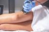 Photo for Cellulite Treatments Market Worth $2,806.60 Million By 2026