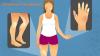Photo for Scleroderma Therapeutics Market Size Worth $2.6 Billion By 2026