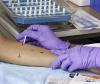 Photo for Food Allergy Diagnostics and Therapeutics Market Size, Share, Growth, Trends and Industry Analysis Report, 2019 to 2026