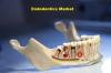 Photo for Global Endodontics Market Size, Share, Growth And Forecast To 2024