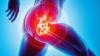 Photo for Hip Replacement Implants Market Size Worth $7.8 Billion By 2026