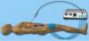 Photo for Radiofrequency Ablation Devices Market Worth $6.7 Billion By 2026