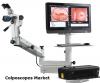 Photo for Colposcopes Market Provides An In-Depth Insight Of Sales And Trends Forecast To 2024