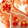 Photo for Global Cholesterol Market 2020 | Manufacturers, Regions, Type and Application, Forecast to 2025