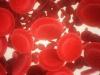 Photo for Global Oral Anticoagulant Market 2020 | Manufacturers, Regions, Type And Application, Forecast To 2025