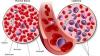 Photo for Acute Myeloid Leukemia Therapeutics Market 2020 Top Comapny Profiles with Forecast Till 2025
