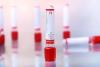 Photo for Vacuum Blood Collection Tube Market 2020 Top Comapny Profiles with Forecast Till 2025