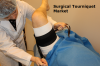 Photo for Surgical Tourniquet Market Research Report, Demand, By Application, Region And Forecast To 2024