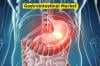 Photo for Gastrointestinal Market Provides An In-Depth Insight Of Sales And Trends Forecast To 2028