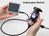 Photo for Endoscopes Market Future Trends, Revenue Growth, Profitability & Leading Players, Forecast To 2027